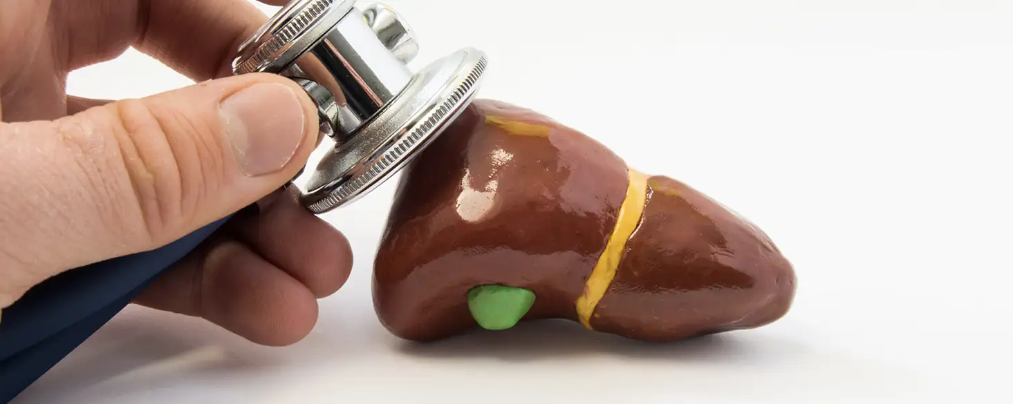 Gallstones treatment image